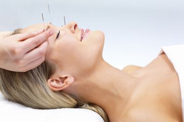 bodyrenewal_acupuncture